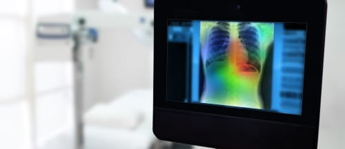 How AI is Transforming the Future of Healthcare