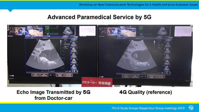 5G x 4G echo image